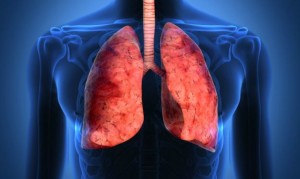 cancro-al-polmone